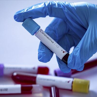 Yeni araştırma! Hangi kan grubu koronayı daha ağır geçiriyor