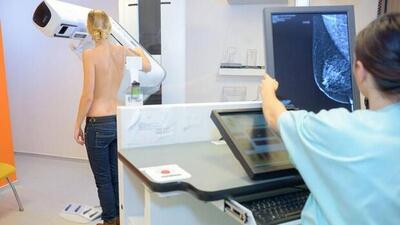 Meme kanserinin erken teşhisinde mamografi yöntemi