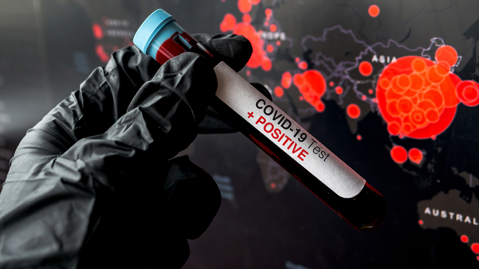 O araştırma kan grubu A olanları korkuttu!