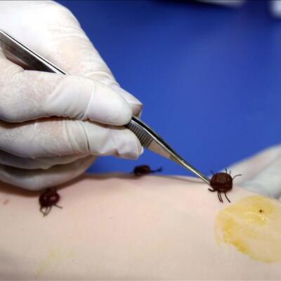 Kene nasıl bulaşır?