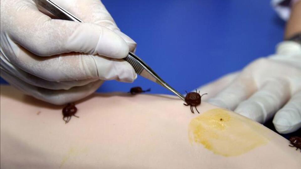 Kene nasıl bulaşır?