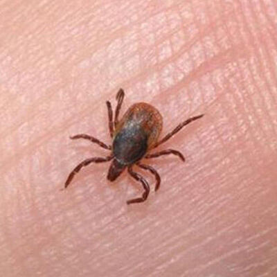 Kene nasıl çıkartılır?