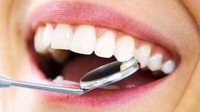 Diş taşı (Tartar) oluşumu ve temizliği