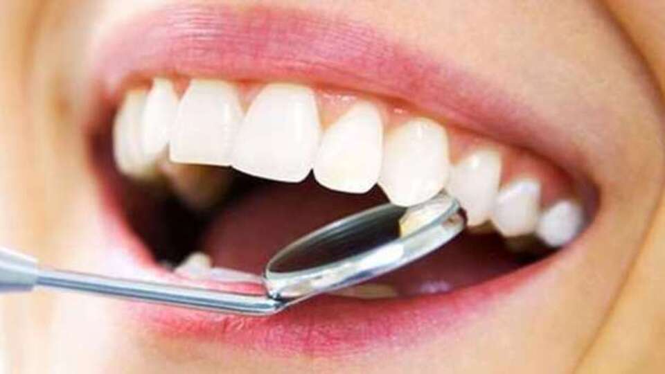 Diş taşı (Tartar) oluşumu ve temizliği