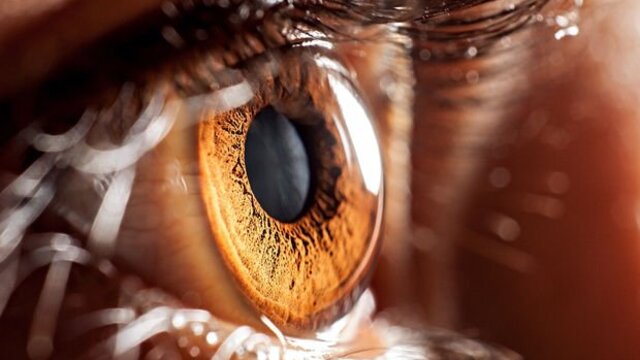Uzmanından salgın döneminde lens kullanımına ilişkin uyarı!