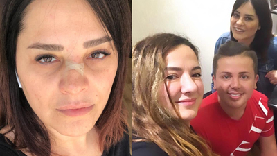 Ünlü şarkıcının burnu kırıldı