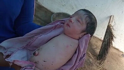 Kolları ve bacakları olmadan doğdu! Şaşkına çevirdi