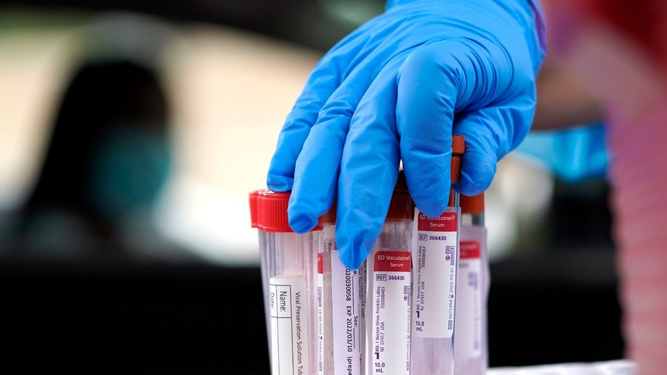 Koronavirüs salgınında yeni vaka sayısı 1356