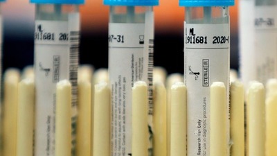 Görevden alınan başkanın testi pozitif çıktı