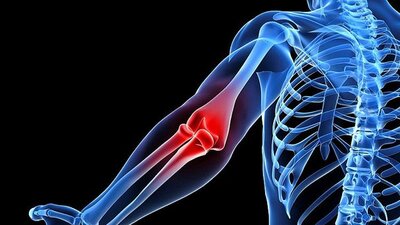 Kireçlenme nedenleri, tanısı ve tedavisi