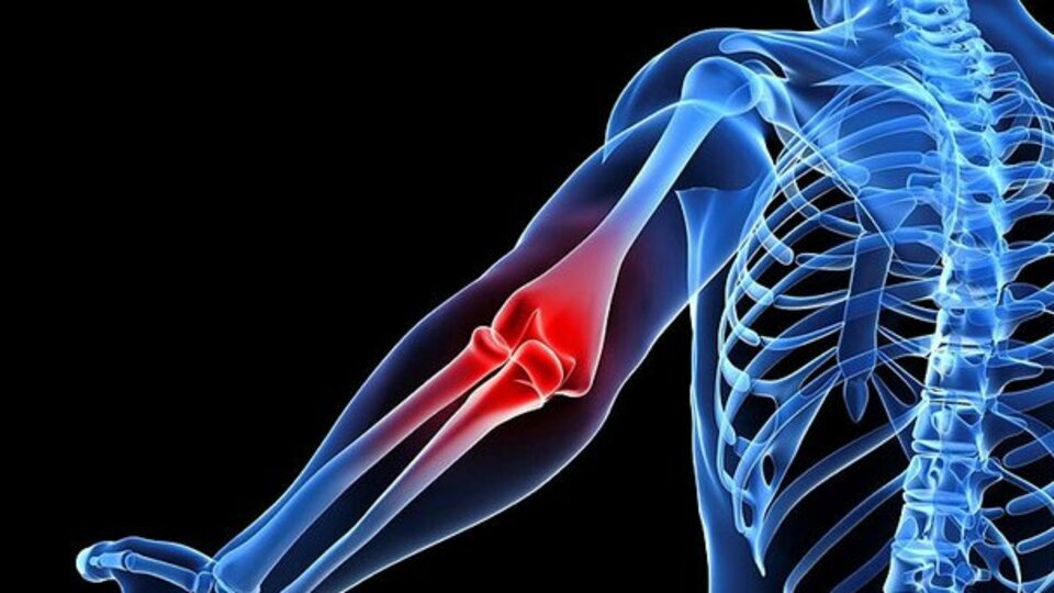 Kireçlenme nedenleri, tanısı ve tedavisi