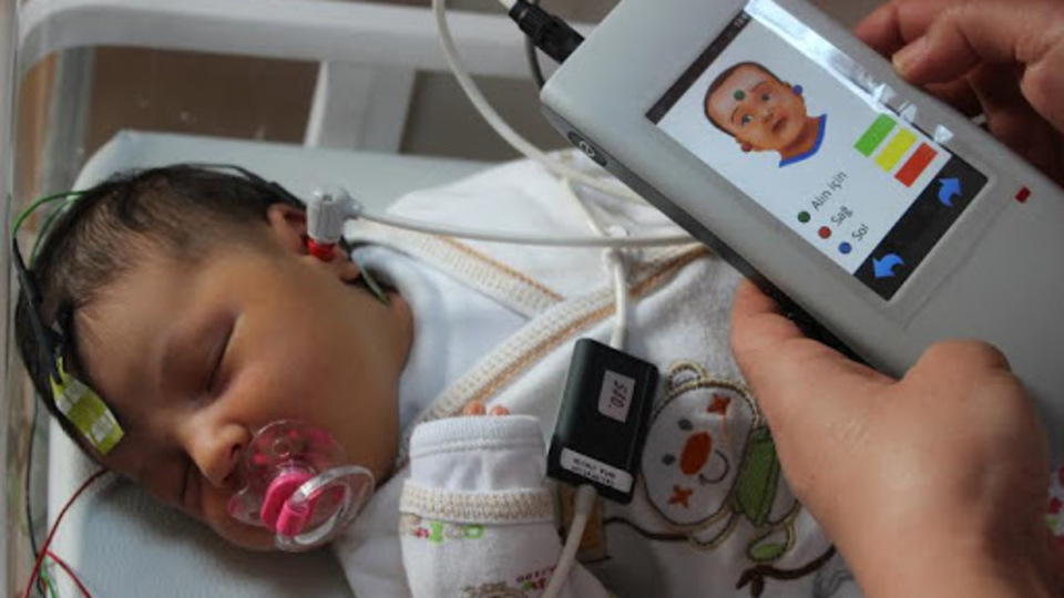 Bebeklerde ABR testi