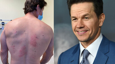 "Her şeye alerjim var"