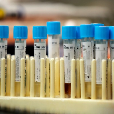 Koronavirüs salgınında yeni vaka sayısı 1172