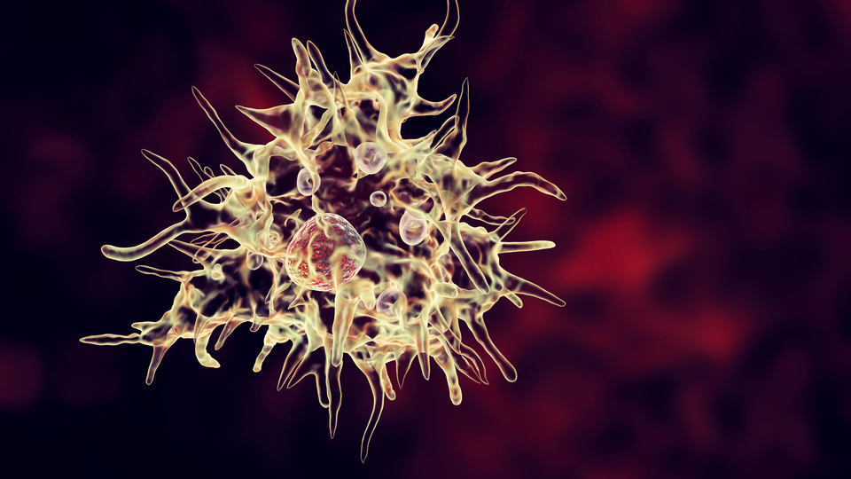 Korkunç! Beyin yiyen amip vakasına rastlandı