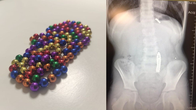 Bu oyuncaklara dikkat! Bağırsakları yırtabilir...