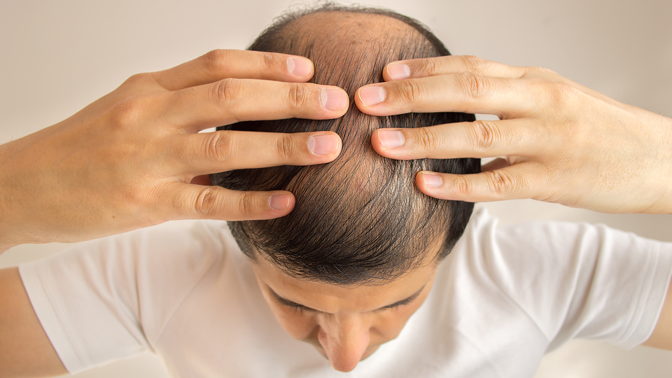 Covid-19 saçımızı da döktü!