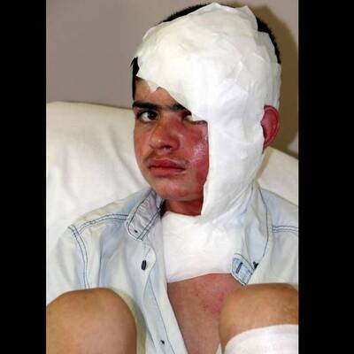 Korkunç 'ihmal'le dehşeti yaşadı!