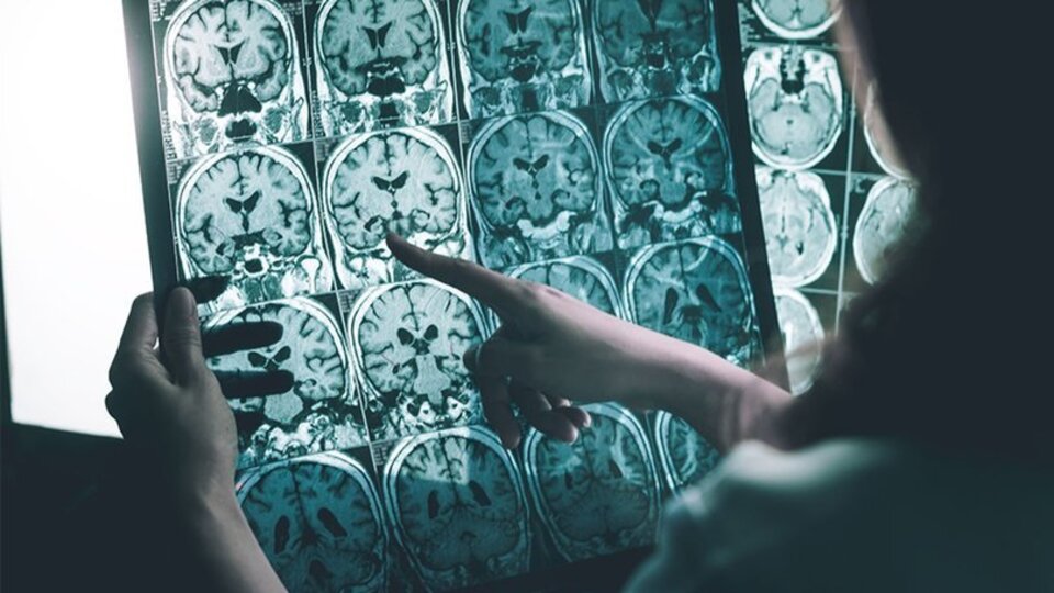 Üniversite öğrencisi Alzheimer'ın peşinde
