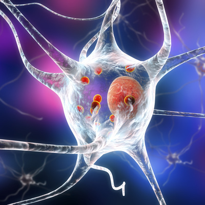Korkutan açıklama! 2040'a kadar 18 milyona ulaşması bekleniyor