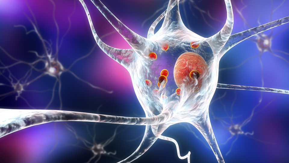 Korkutan açıklama! 2040'a kadar 18 milyona ulaşması bekleniyor