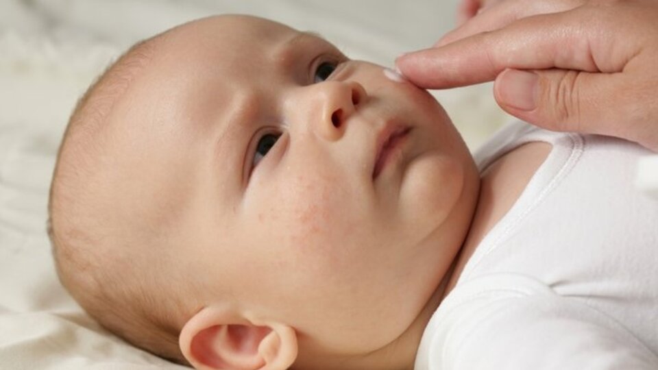 6. hastalık belirtileri ve tedavisi