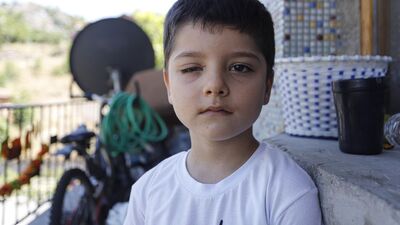 İnternette gördü, gözünden oldu!