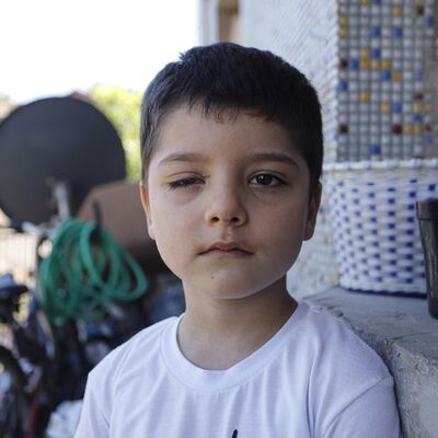 İnternette gördü, gözünden oldu!