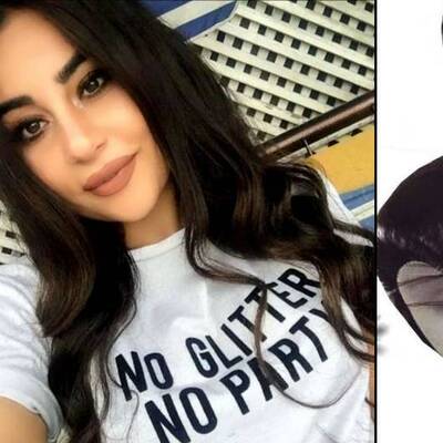 Zeynep'in kan donduran otopsi raporu!