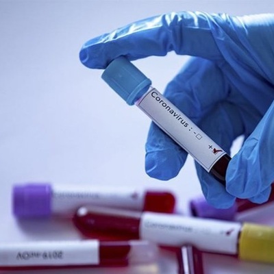 Koronavirüs salgınında yeni vaka sayısı 963