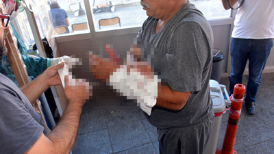 Acemi kasaplar hastanelik