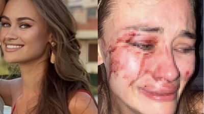 Bakan Ersoy: Bu magandalık yanına kâr kalmayacak