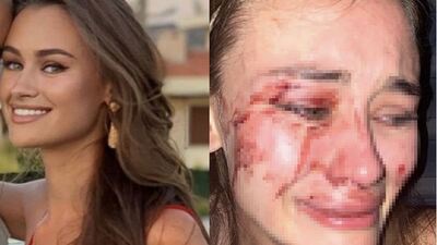 "Misafirlerimize çirkin davrananlar bunun bedelini öder"