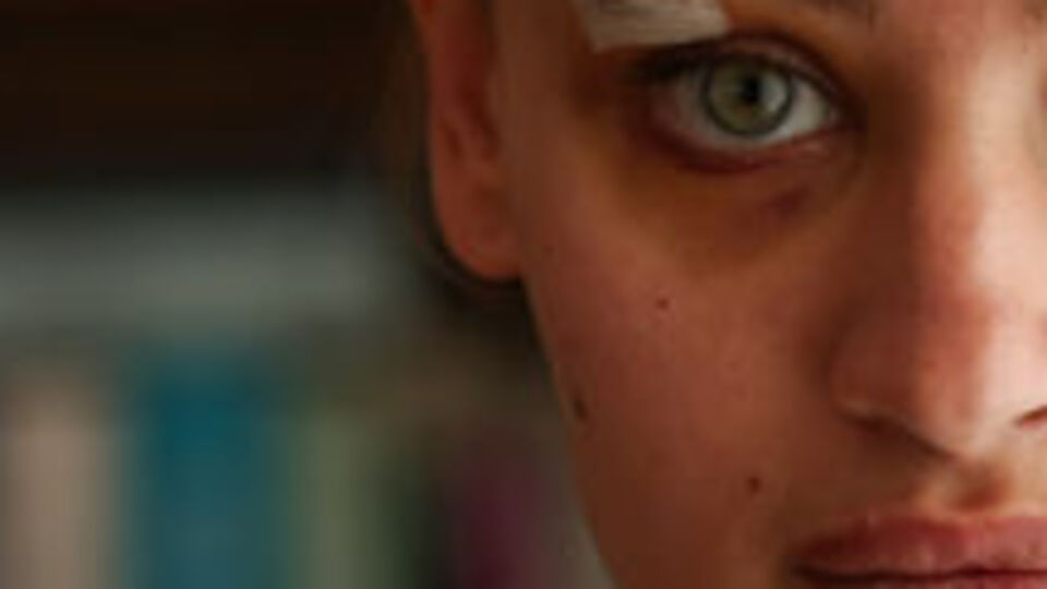 Ukraynalı model Daria Kyryliuk darp iddiasıyla ilgili konuştu