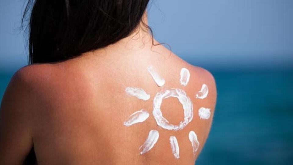 Güneş alerjisinde tedavi yöntemleri
