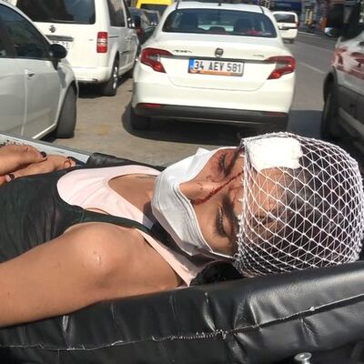 Sevgilisi bu hale getirdi! Bankaya sığındı!