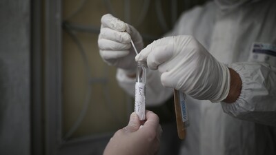 Hıçkırık koronavirüsün yeni belirtisi mi?