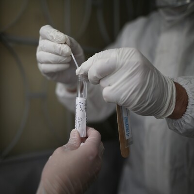 Hıçkırık koronavirüsün yeni belirtisi mi?