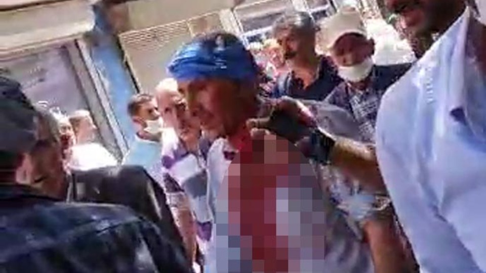 Ağrı'da iki aile arasında taşlı sopalı kavga: 9 yaralı!