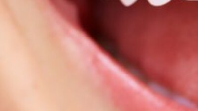 Diş eti çekilmesi nedenleri