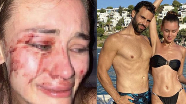 Ünlü model Bodrum'da! Darp iddialarıyla gündeme gelmişti...