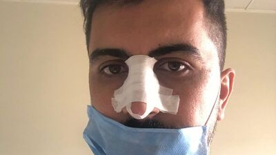 "Sosyal mesafe" dedi! Burnunu kırdılar!