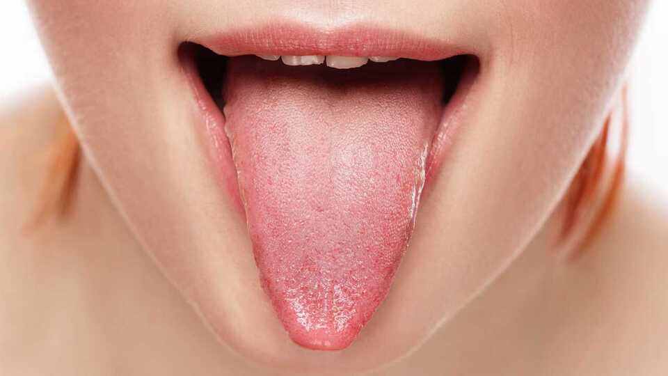 Dil uyuşmasının nedenleri