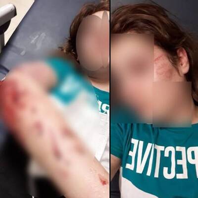 Ağabey dehşeti! İkinci kattan atladı