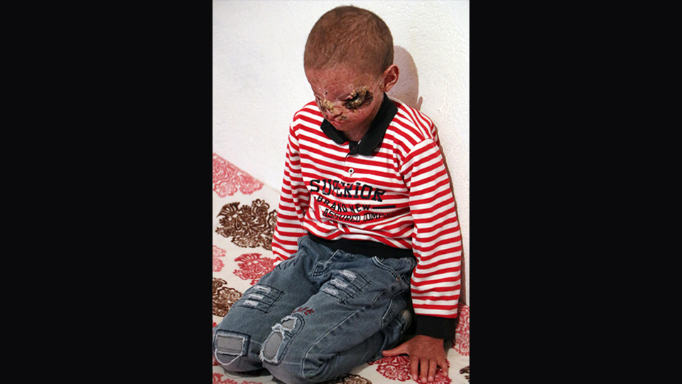 Salih'in tedavisi başladı