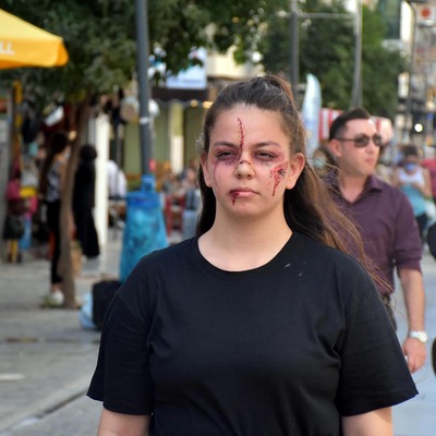 Kesik, morluk ve yara iziyle dışarı çıktı... İşte işin aslı