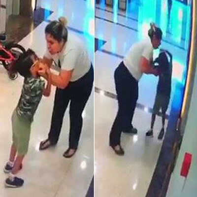 Köpeği sevdi! Kabusu yaşadı!