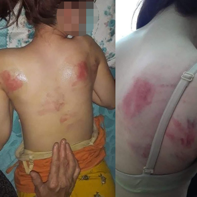 Telefon şifresini söylemeyen kızını, İngiliz anahtarıyla dövdü
