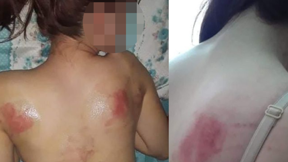 Telefon şifresini söylemeyen kızını, İngiliz anahtarıyla dövdü