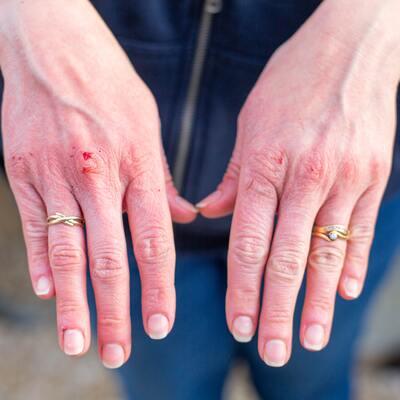 Dikkat! Koronanın bir belirtisi olabilir...